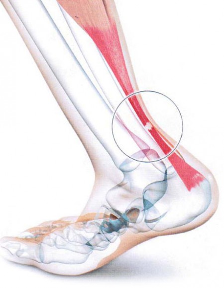 Tendon-Achille-anatomie